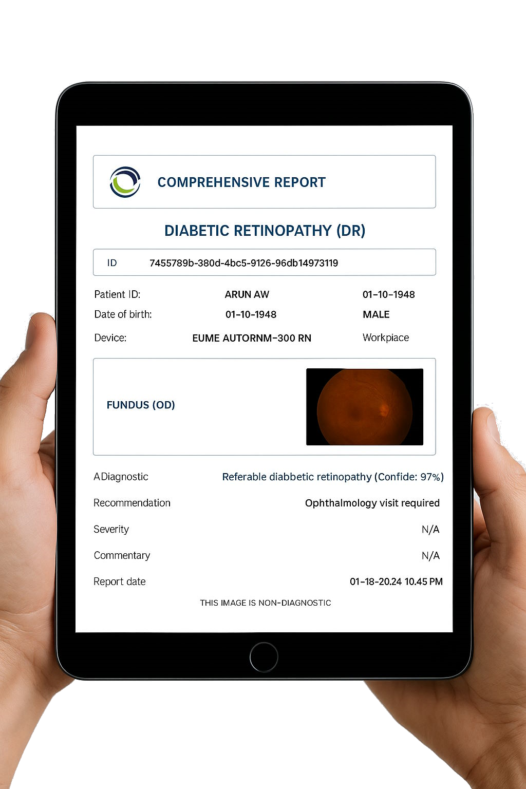 direscan-tablet-transparent